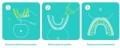 Spazzolino sonico per denti a forma di U, 360°