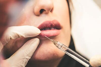 Trucco permanente per labbra e filler